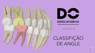 CLASSIFICAÇÃO DE ANGLE - Princípios da Ortodontia  parte 1.