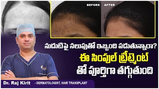 Pigmentation Treatment on Forehead || How to Get Rid of Dark Spots on Forehead || Celestee