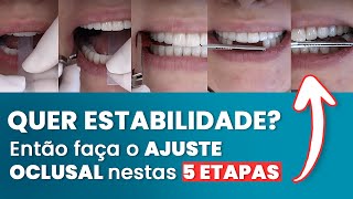 AS 5 ETAPAS DO AJUSTE OCLUSAL ESTÁVEL - Mylene e Renato