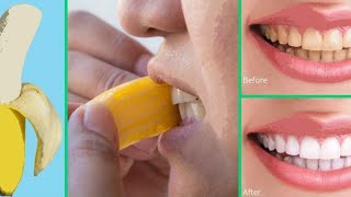 6 Effective Ways to Remove Dental Plaque Naturally