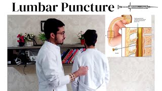 Queckenstedt Sign | Lumbar Puncture | Taking CSF | Vomiting In Patients | Urdu/Hindi | Neuroanatomy