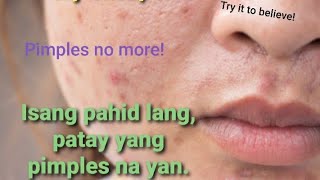 How to dry your pimples in one day! Paano matuyo agad ang pimples!