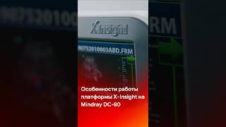 Особенности работы платформы X-Insight на Mindray DC-80 #shorts #short #tiktok #reels #узи #обзор