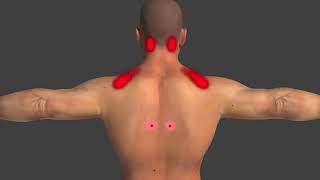 Trigger Points