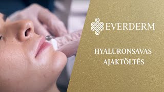 Hyaluronsavas arcfeltöltés