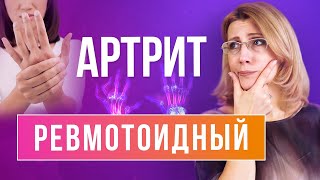 Ревматоидный артрит // Взаимосвязь между состоянием, симптомами и причинами