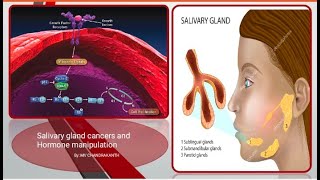 salivary gland cancers#Adenoid cystic carcinoma#Androgen receptor#Novel Treatment#Abiraterone#ATRA