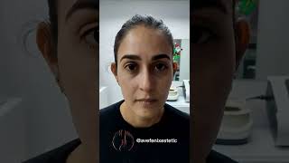 ¿Hasta cuándo la mala información sobre el Botox? #avefenixestetic