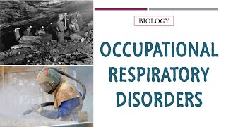 OCCUPATIONAL RESPIRATORY DISEASES | BIOLOGY