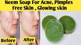 Homemade Neem Soap For Clear, Bright & Acne Free Skin, Glowing skin/Neem Soap At Home