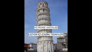 Peyronie Hastalığı 3) Lezyon (Peyronie Plağı) İçi Enjeksiyon (Enzim) Tedavileri