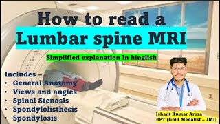 How to read your lumbar spine MRI | Hindi | Disc slip | Ishant Arora | PhyX Pain Solutions