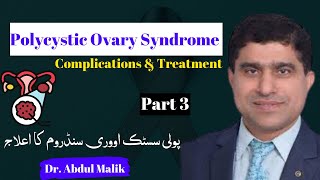 Polycystic Ovary Syndrome (PCOS)| Complications of PCOS | Treatment of PCOS part 3