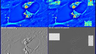 Microglial cell dynamics