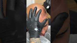 A little ASMR for this first session of a cosmetic hair loss tattoo.