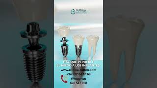 SONREÍR CON IMPLANTES DENTALES