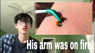 HIS ARM WAS ON FIRE! Stung by A Cow Killer (Brave Wilderness) reaction