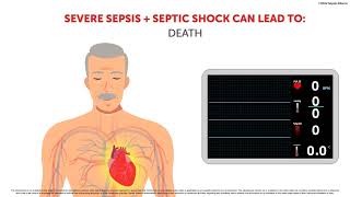 The Effects of Sepsis