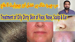 Oily Skin or Seborrhea Treatment in Urdu | Treating Oily Scalp, Face, Nose, Ear & Chest | Dandruff