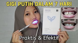 CARA MEMUTIHKAN GIGI DALAM 7 HARI | Review jujur Teeth Whitening Beaudelab