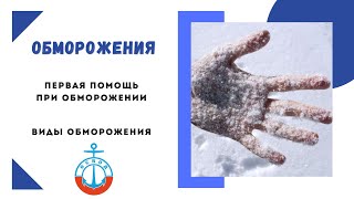 Обморожения ! Первая Помощи при Обморожениях! Степени Обморожения! Как Помочь при Обморожениях!