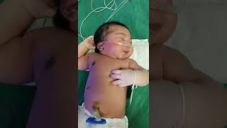 viralshort#trendingshorts #newborn #soooo #cute #oxygen baby#subscribe my channel#