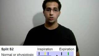 Polygram -Part 3- (Physiology 2nd Year) - AbdulRahman Ismaiel