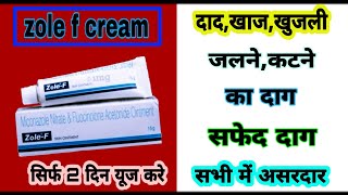 zole f skin ointment in hindi||zole f ointment in hindi||zole f cream