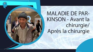 MALADIE DE PARKINSON - Avant la chirurgie/ Après la chirurgie #parkinson #youtubeshorts #shorts