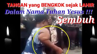 VIRAL, TANGAN BENGKOK SEJAK LAHIR JADI NORMAL || MUZIJAT NYATA || KUASA TUHAN YESUS || PUJI TUHAN!