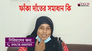 ফাঁকা দাঁতের চিকিৎসার পরে রোগীর অনুভূতি দেখুন। ১ দিনে ফাঁকা দাঁতের চিকিৎসা। Tech Dental