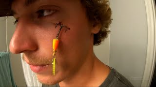 How to remove fish hook from face