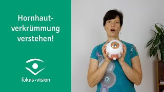 Die verblüffenden Hintergründe der Hornhautverkrümmung (Astigmatismus)