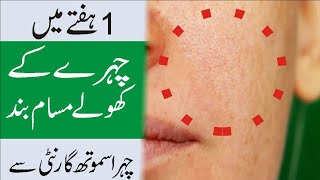 1 week Remedy For Open Pores Treatment #openporesremedy #openporestreatment #skincare #viral #asmr