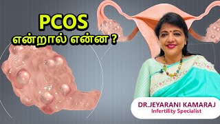 PCOS என்றால் என்ன?