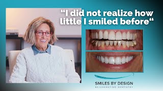 Julie's Story - "I did not realize how little I smiled before"