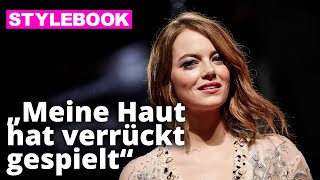 Emma Stone im Interview: Mein Geheimrezept gegen Akne | STYLEBOOK