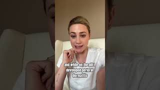 Lili Reinhart about her acne issues