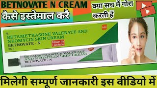 Betnovate N Cream use in Hindi क्या betnovate N क्रीम लगाने से चेहरा गोरा होता है