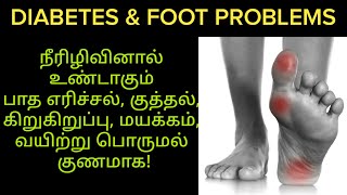 How to cure diabetic foot problem in tamil| நீரிழிவினால் உண்டாகும் பாத எரிச்சல் குத்தல் குணமாக| Tips