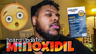 Growing Beard With Minoxidil Week 20