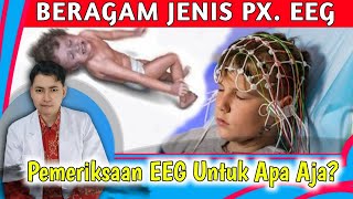 Bukan Cuma Epilepsi, Mengenal EEG Elektroensefalografi untuk Mendeteksi Kelainan Otak