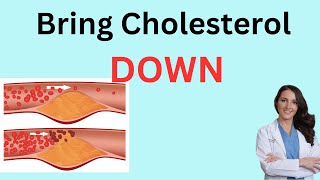 Bring Your Cholesterol DOWN WITHOUT MEDS!  Easy way to lower your cholesterol 2023