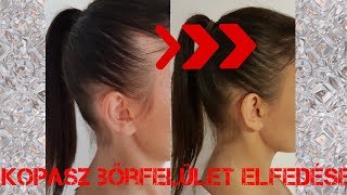 Kopasz bőrfelület elfedése