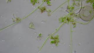 Fresh Water Sample with Rotifer Egg, Vorticella, Arcella and Nematode