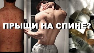 Как избавиться от прыщей на спине?// Уход за кожей тела