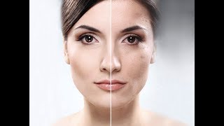 Revealing the Secret to Fighting Unwanted Age Spots!