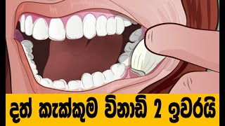 දත් කැක්කුම විනාඩි 2න් ඉවරයි | Home Remedies for Toothache Sinhala