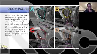 Contouring Pelvis | Session 5: Prostate intact