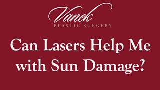 Can Lasers Help with Sun Damage?